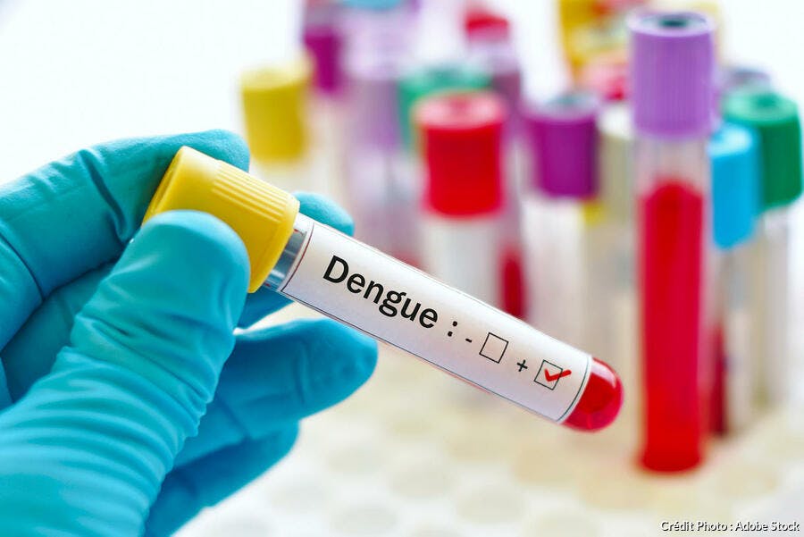 Test sanguin en laboratoire de la dengue transmise par le moustique tigre